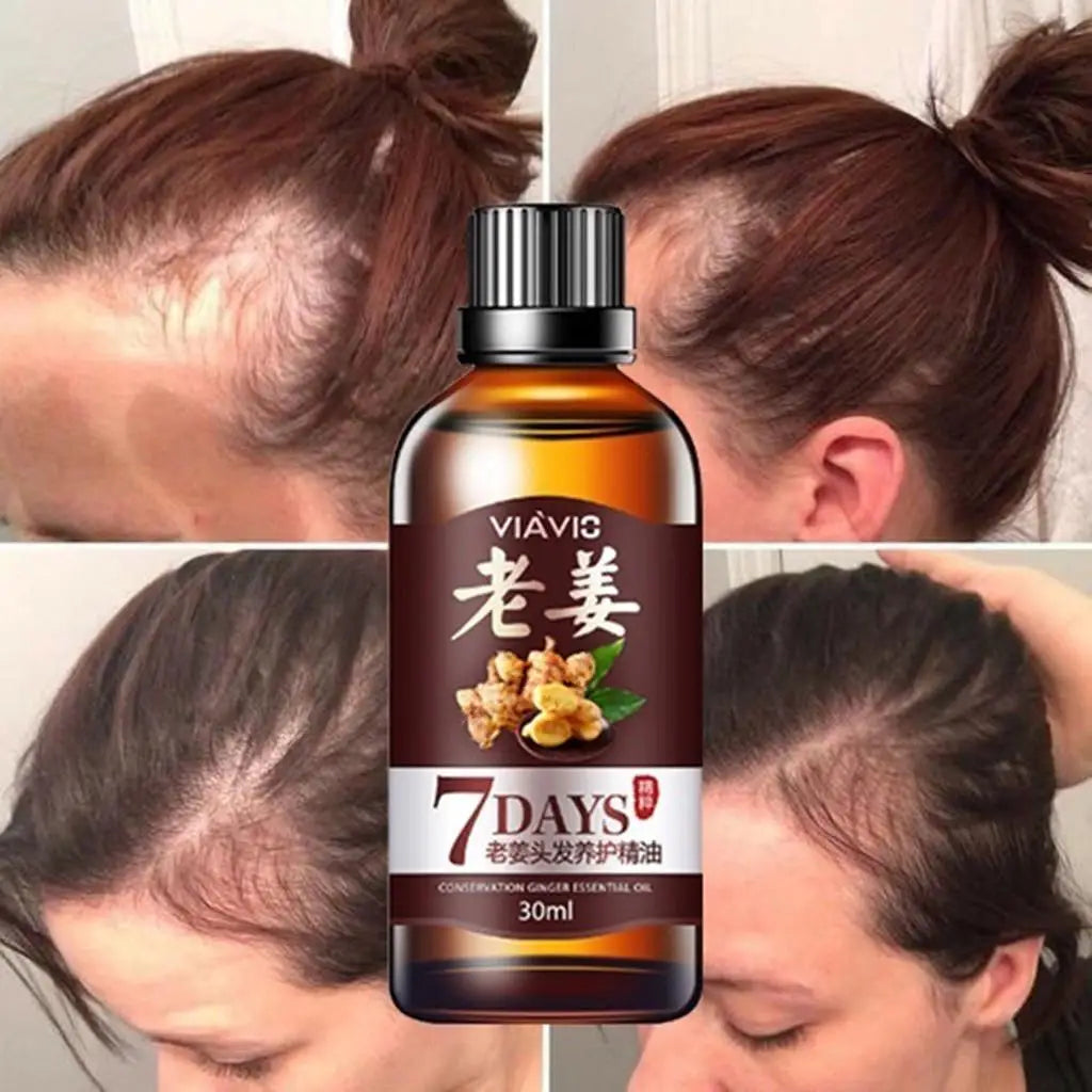 Socks.Fast Hair Growth Dense Regrowth Ginger Serum Oil Anti Loss Treatment 30ML