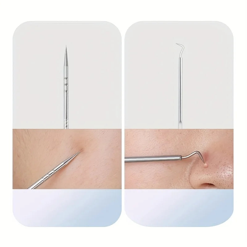 Stainless steel blackhead and pimple extractor skincare tool set — view 4