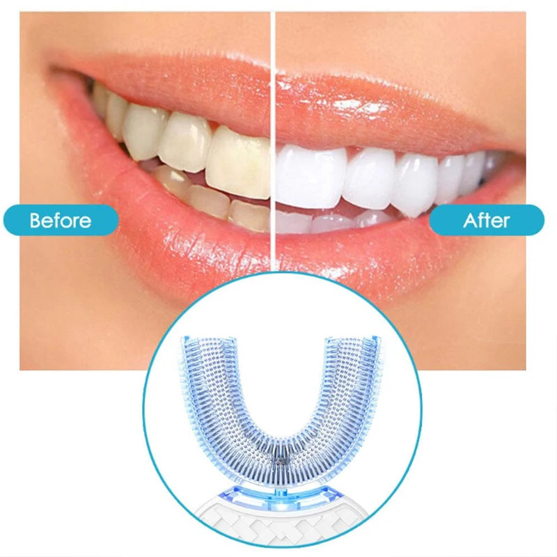 Intelligent Automatic U Type Modes Tooth Brush Sonic Electric Toothbrush USB Rechargeable Tooth Whitening Blue Light