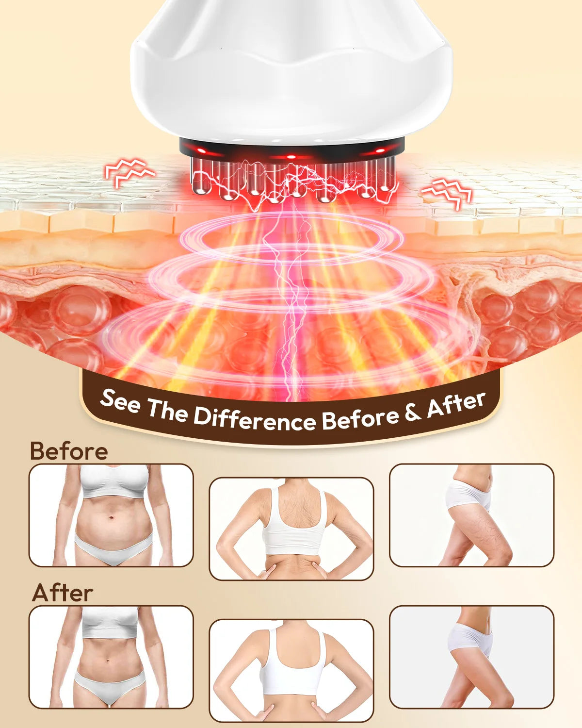 Lymphatic Drainage Massager — Anti-Cellulite Body-Sculpting Tool with Heat — view 4 of recovery & massage