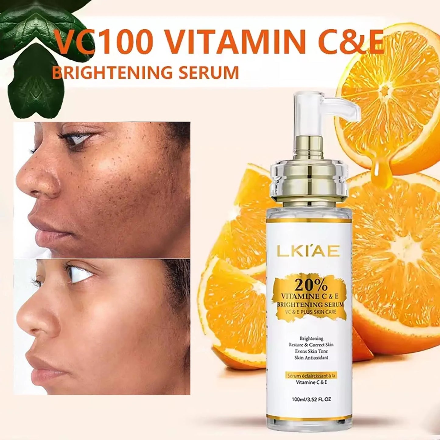 AILKE Brightening Body Lotion — Vitamin C + Hyaluronic Acid for Even Skin Tone