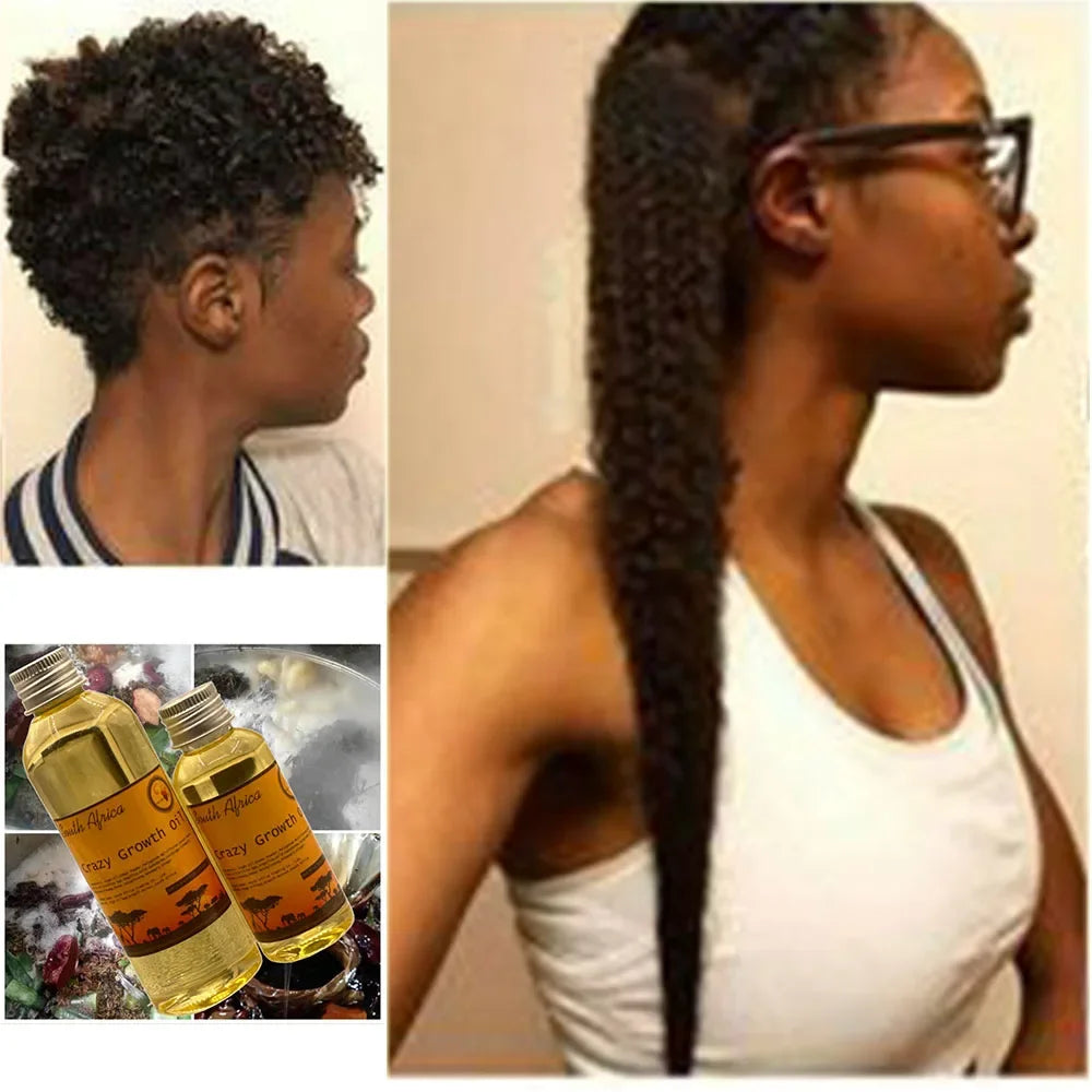 50 ml Traditional African Hair Oil GROW YOUR HAIR FASTER LONGER IN 1 WEEK Helps To Stop Breakage