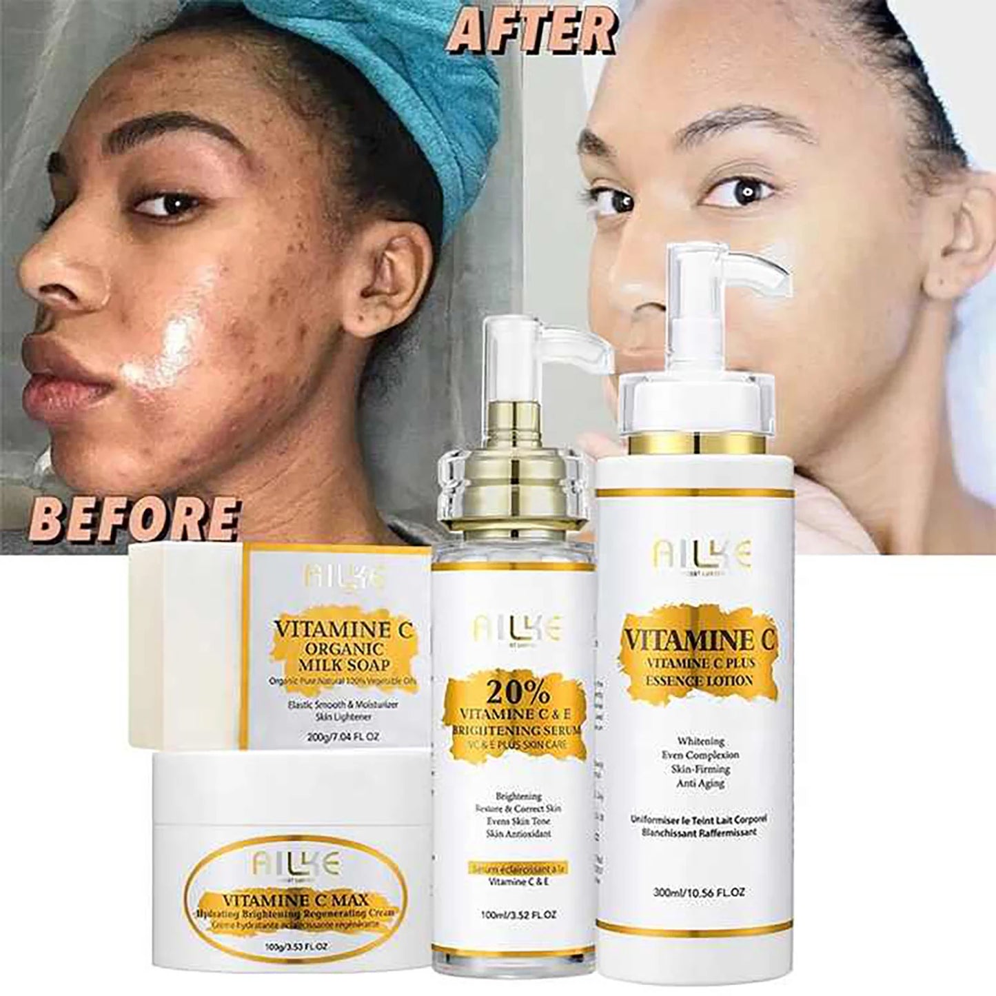 AILKE Brightening Body Lotion — Vitamin C + Hyaluronic Acid for Even Skin Tone