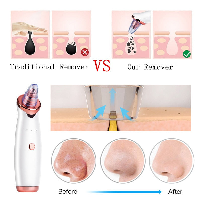 Facial Blackhead Remover Electric Acne Cleaner Blackhead Black Point Vacuum